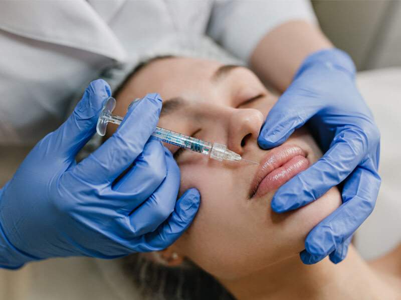 Dermal fillers treatment for facial rejuvenation at Cosmedent Medical Center Dubai