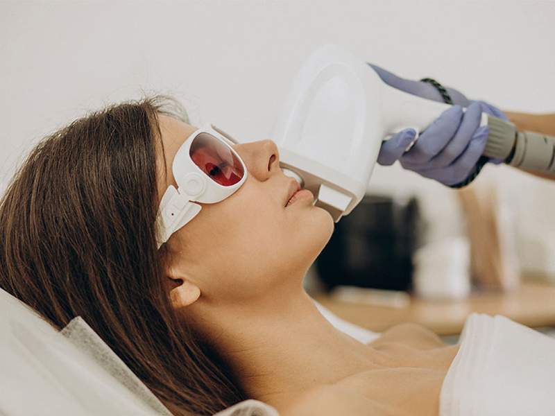 Laser hair bleaching treatment at Cosmedent Medical Center Dubai
